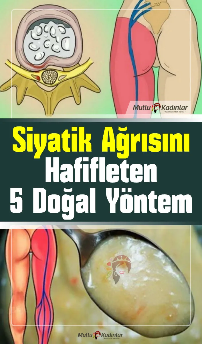 Siyatik ağrısını hafifleten 5 doğal yöntem!
